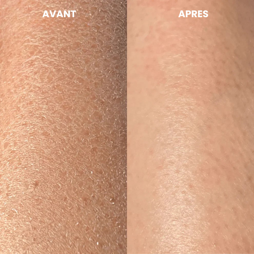Gant exfoliant Lunelya™
