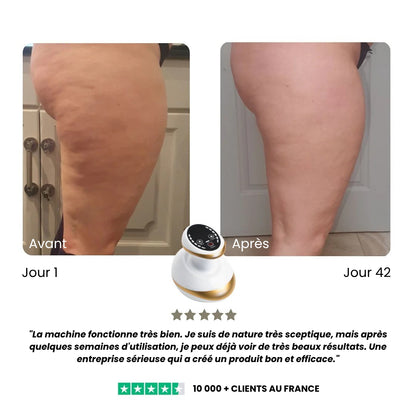 bodySculpt 1.0™