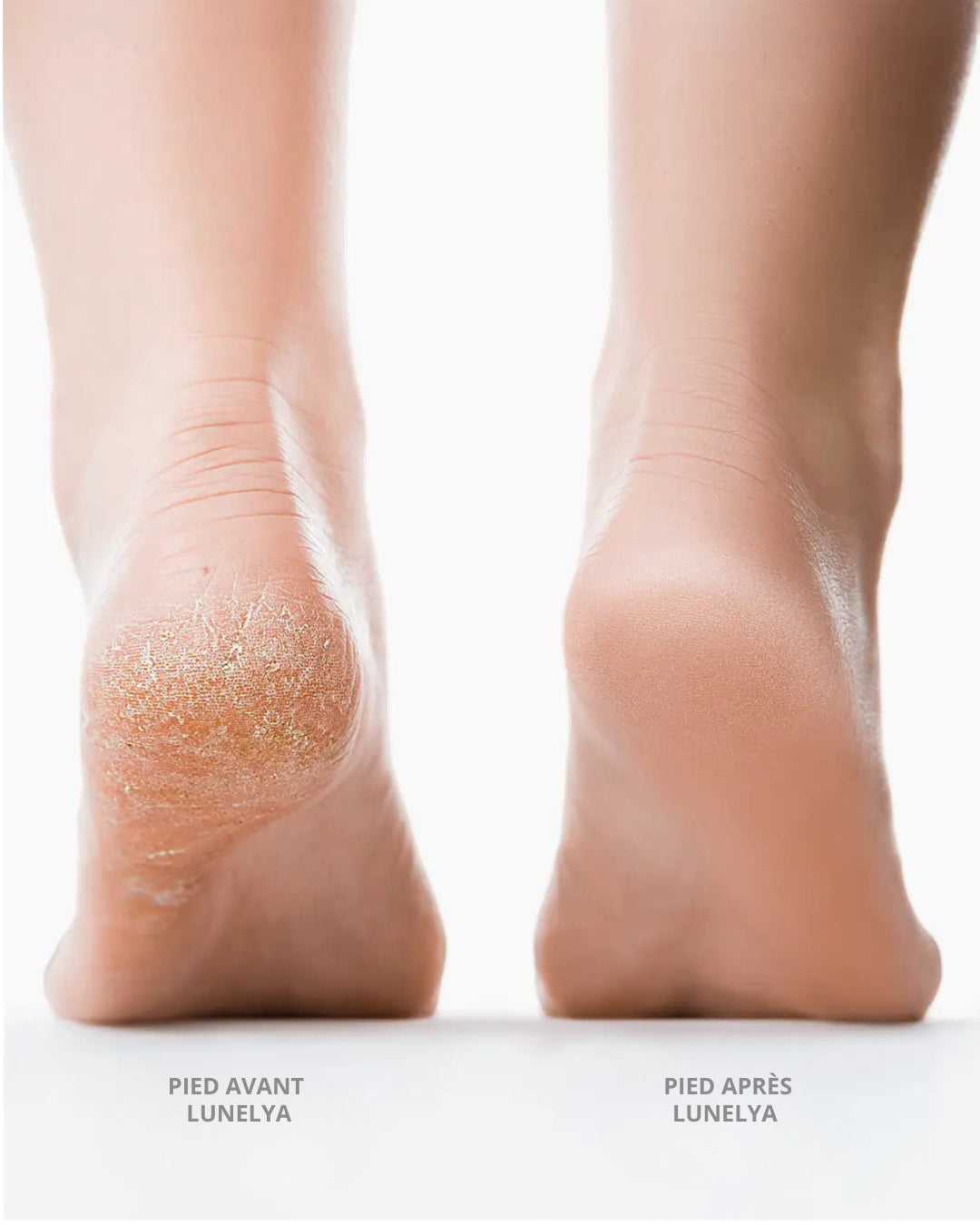 Lunelya™ Silk 3 Pro – Lime Électrique Anti-Callosités