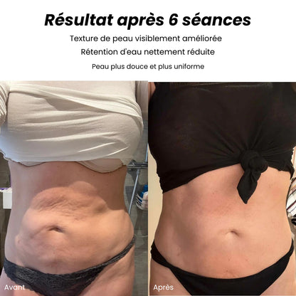 bodySculpt 1.0™