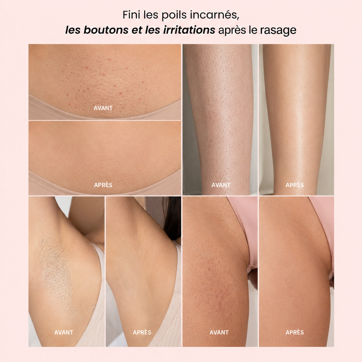 Rasoir Intime Femme Lunelya™ — Peau Lisse, Zéro Irritation